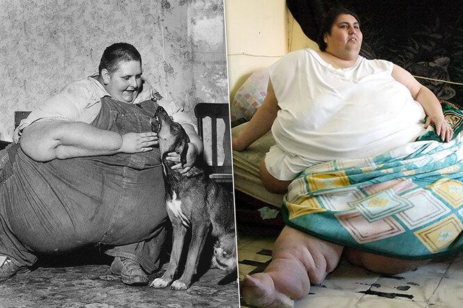 Минус 500! Истории похудения самых тяжёлых людей в мире