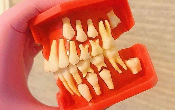 Улыбка с ошибкой: 5 вещей, которые нельзя делать со своими зубами у стоматолога
